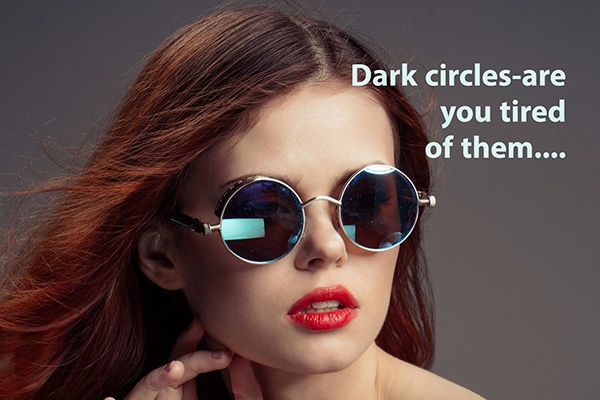 Dark-circles-under your eyes