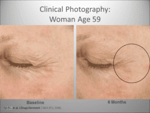 TNS-results-anti ageing